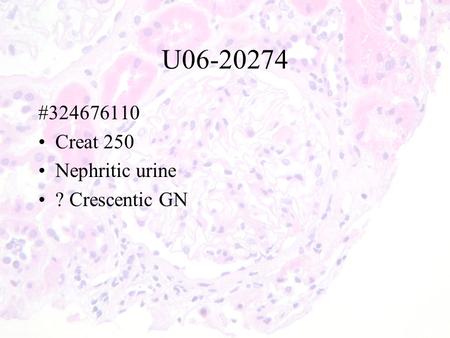 U06-20274 #324676110 Creat 250 Nephritic urine ? Crescentic GN.