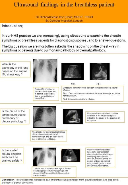 Ultrasound findings in the breathless patient