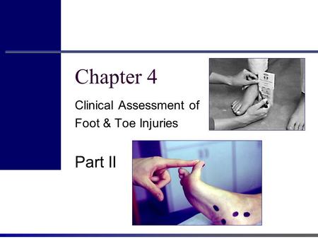 Chapter 4 Clinical Assessment of Foot & Toe Injuries Part II.