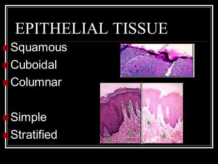 EPITHELIAL TISSUE Squamous Cuboidal Columnar Simple Stratified.