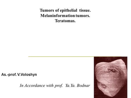 Tumors of epithelial tissue. Melaninformation tumors. Teratomas. In Accordance with prof. Ya.Ya. Bodnar As.-prof. V.Voloshyn.