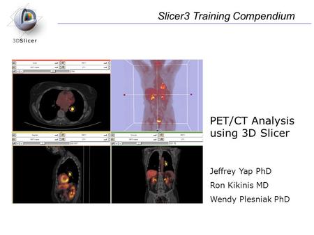PET/CT Analysis using 3D Slicer Jeffrey Yap PhD Ron Kikinis MD Wendy Plesniak PhD Slicer3 Training Compendium.