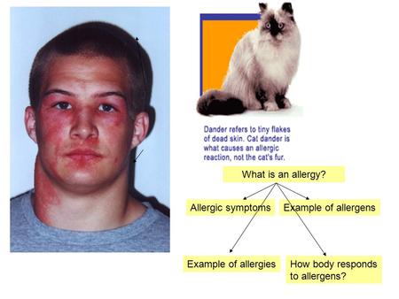 What is an allergy? Example of allergensAllergic symptoms Example of allergiesHow body responds to allergens?