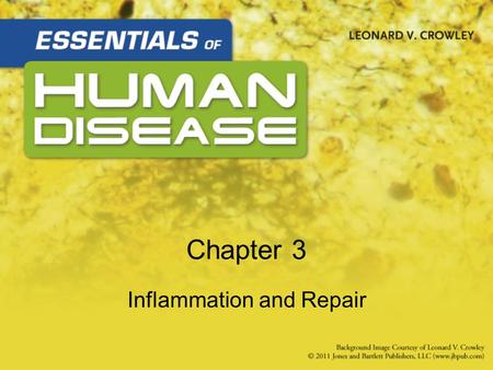 Chapter 3 Inflammation and Repair.