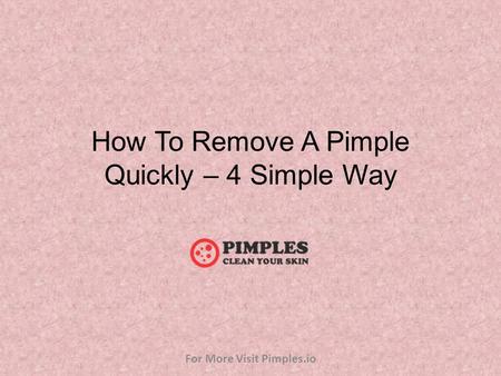 How To Remove A Pimple Quickly – 4 Simple Way For More Visit Pimples.io.