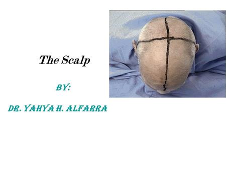 The Scalp BY: DR. Yahya h. Alfarra. The Scalp Definition layers Muscle of scalp nerve supply of scalp Arterial supply of scalp Veins of scalp.