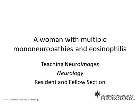 A woman with multiple mononeuropathies and eosinophilia Teaching NeuroImages Neurology Resident and Fellow Section © 2014 American Academy of Neurology.