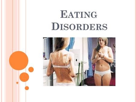 E ATING D ISORDERS. W HAT ARE EATING DISORDERS ? An eating disorder is a change in one’s normal eating habits which can cause a drastic change in weight.