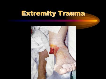 Extremity Trauma. Anatomy Bones Joints Nerves Soft tissue.