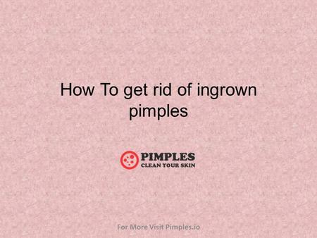How To get rid of ingrown pimples