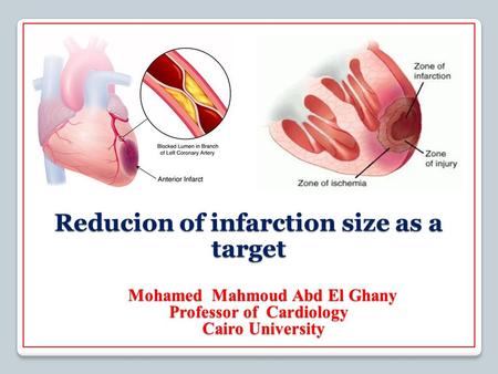 S Reducion of infarction size as a target Mohamed Mahmoud Abd El Ghany Mohamed Mahmoud Abd El Ghany Cardiology Professor of Cairo University.
