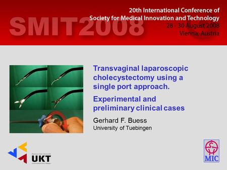 Transvaginal laparoscopic cholecystectomy using a single port approach. Experimental and preliminary clinical cases Gerhard F. Buess University of Tuebingen.