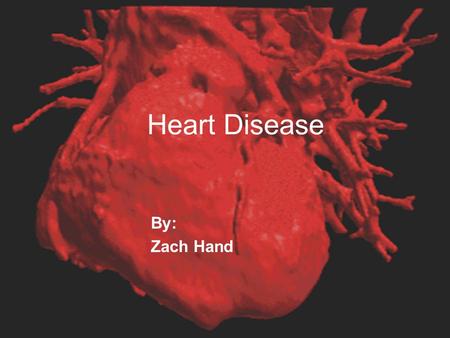 Heart Disease By: Zach Hand. Table of contents  What is Heart Disease?  Types of Heart disease  Heart Attack  Heart Failure  Endocarditis  One Day.
