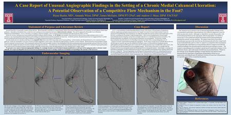 A Case Report of Unusual Angiographic Findings in the Setting of a Chronic Medial Calcaneal Ulceration: A Potential Observation of a Competitive Flow Mechanism.