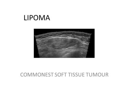 LIPOMA COMMONEST SOFT TISSUE TUMOUR. Aim: To assess ultrasound characteristics of a lipoma that may suggest atypical nature or frank sarcoma Study: Population;