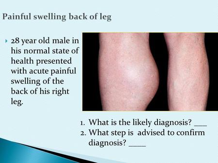 Painful swelling back of leg  28 year old male in his normal state of health presented with acute painful swelling of the back of his right leg. 1.What.