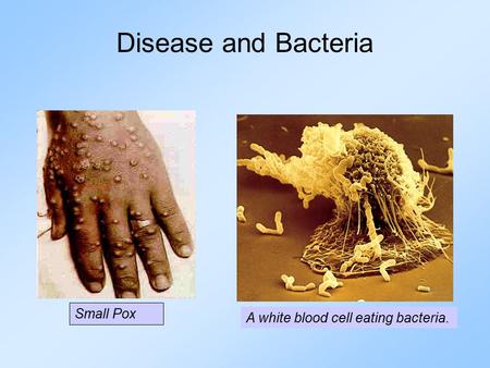 Disease and Bacteria Small Pox A white blood cell eating bacteria.