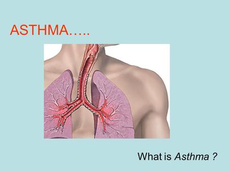 ASTHMA….. What is Asthma ?.