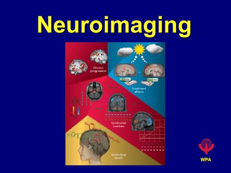 WPA Neuroimaging. WPA Basic Principles of Brain Imaging Some technique is used to measure a signal in the brain (e.g., the degree to which an xray beam.
