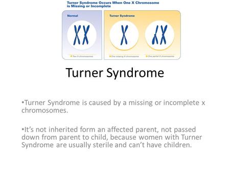 Turner Syndrome Turner Syndrome is caused by a missing or incomplete x chromosomes. It’s not inherited form an affected parent, not passed down from parent.