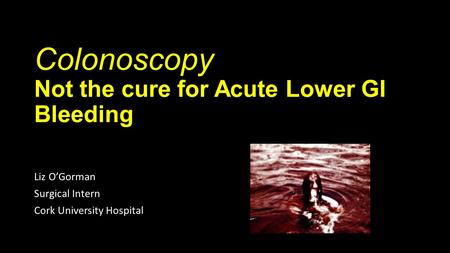 Colonoscopy Not the cure for Acute Lower GI Bleeding
