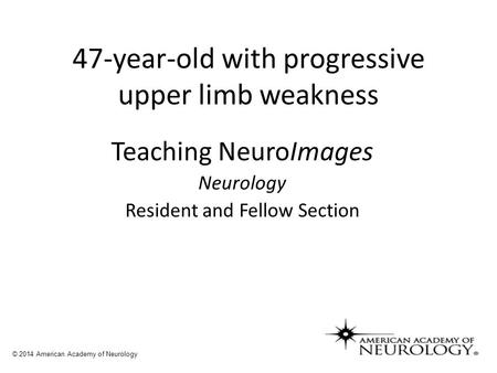 47-year-old with progressive upper limb weakness Teaching NeuroImages Neurology Resident and Fellow Section © 2014 American Academy of Neurology.