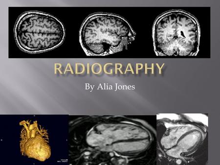 RadioGraphy By Alia Jones.