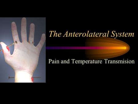 The Anterolateral System Pain and Temperature Transmision.