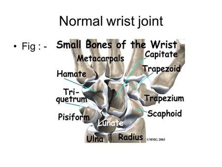 Normal wrist joint Fig : -.