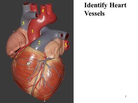 1 Identify Heart Vessels 1 2 3 4 5. 2 Identify Heart Vessels & Structures 6 9 10 7 8.