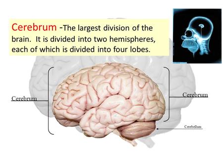 Cerebrum - The largest division of the brain. It is divided into two hemispheres, each of which is divided into four lobes. Cerebrum Cerebellum.