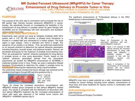 PURPOSE The purpose of this work was to commission and to evaluate the role of MR guided high intensity focused ultrasound (MRgHIFU) in cancer therapy.