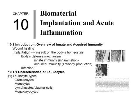 CHAPTER10 Biomaterial Implantation and Acute Inflammation 10.1 Introduction: Overview of Innate and Acquired Immunity Wound healing Implantation --- assault.