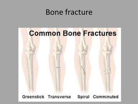 Bone fracture. 1- Simple fracture. clean break overlying skin. 1- Simple transverse fractures at right-angles broken stick of chalk. 2- Simple oblique.