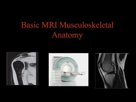 Basic MRI Musculoskeletal Anatomy. Musculoskeletal MRI Indications Sport related injuries Mensical abnormalities Osteonecrosis Bone marrow abnormalities.