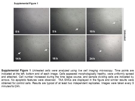10 h5 h 0 h Supplemental Figure 1 14 h 16 h 24 h Untreated Supplemental Figure 1 Untreated cells were analyzed using live cell imaging microscopy. Time.