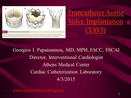 Trancatheter Aortic Valve Implantation (TAVI)