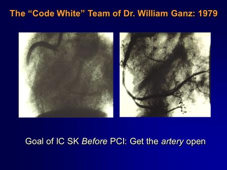 The “Code White” Team of Dr. William Ganz: 1979 Goal of IC SK Before PCI: Get the artery open.