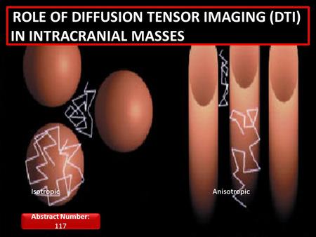 IsotropicAnisotropic ROLE OF DIFFUSION TENSOR IMAGING (DTI) IN INTRACRANIAL MASSES Abstract Number: 117.