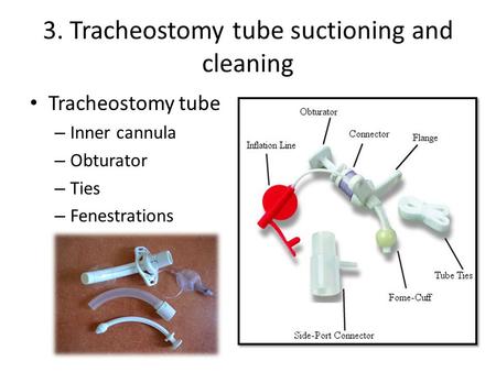 3. Tracheostomy tube suctioning and cleaning Tracheostomy tube – Inner cannula – Obturator – Ties – Fenestrations.