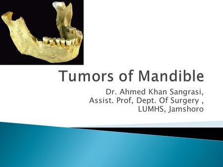 Tumors of Mandible Dr. Ahmed Khan Sangrasi,