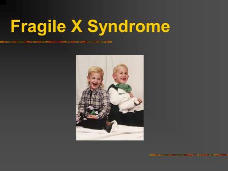 Fragile X Syndrome.