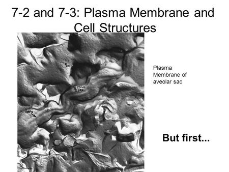 Plasma Membrane of aveolar sac 7-2 and 7-3: Plasma Membrane and Cell Structures But first...