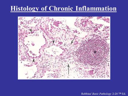 Robbins’ Basic Pathology 2-20 7 th Ed. Histology of Chronic Inflammation.