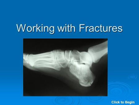 Working with Fractures Click to Begin. Working with Fractures Click to Continue.