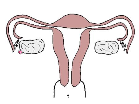 Fallopian Tubes Carry the egg from the ovary to the uterus. The only place the egg can be fertilized. Sperm must through the vagina, uterus, and into.
