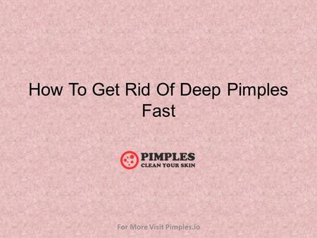 How To Get Rid Of Deep Pimples Fast For More Visit Pimples.io.