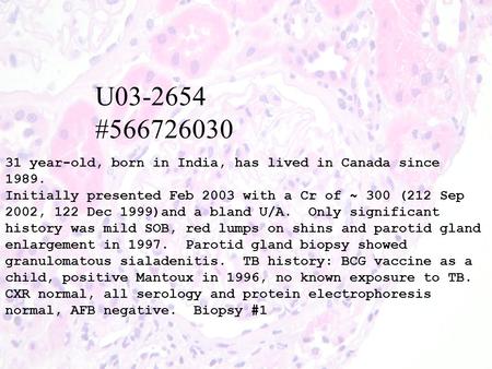 U03-2654 #566726030 31 year-old, born in India, has lived in Canada since 1989. Initially presented Feb 2003 with a Cr of ~ 300 (212 Sep 2002, 122 Dec.