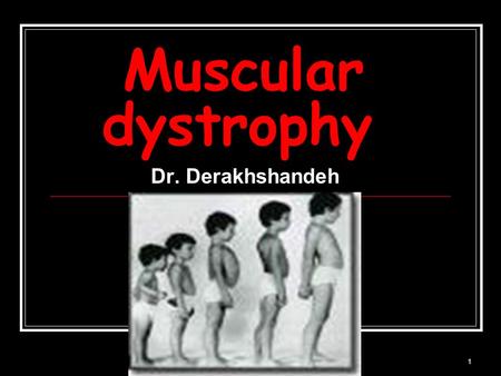 1 Muscular dystrophy Dr. Derakhshandeh. 2 Muscular dystrophy (MD) a group of rare inherited muscle diseases muscle fibers are unusually susceptible to.