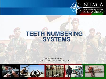 TEETH NUMBERING SYSTEMS
